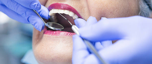 Best Chipped Tooth Repair Near Me  in Rankin, PA